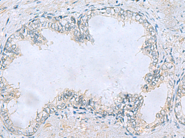 CEP131