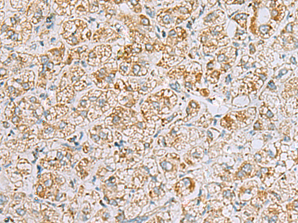 INS(C-peptide)