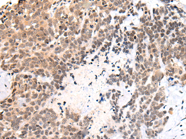 RIOX1
