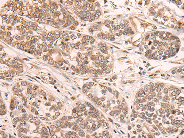 Rabbit Polyclonal Antibody to EMC10