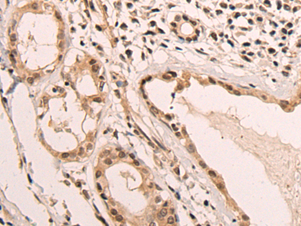 Rabbit Polyclonal Antibody to EMC10