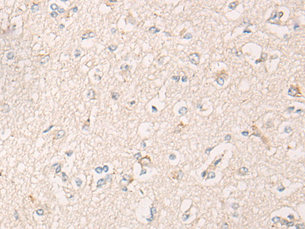 Rabbit Polyclonal Antibody to IBA57