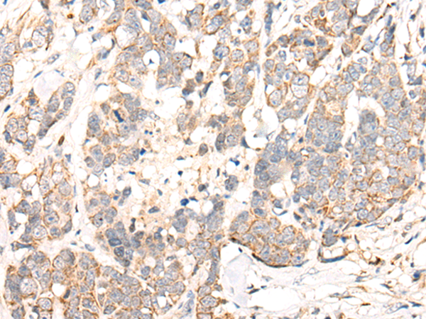 Rabbit Polyclonal Antibody to C1S