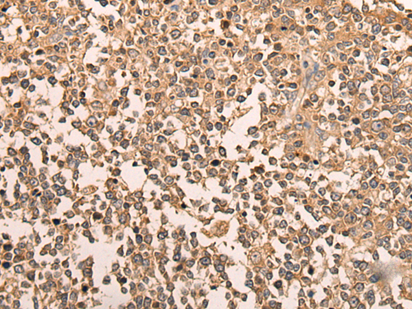 Rabbit Polyclonal Antibody to LDAH