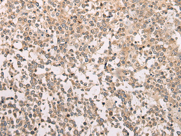 Rabbit Polyclonal Antibody to M1AP