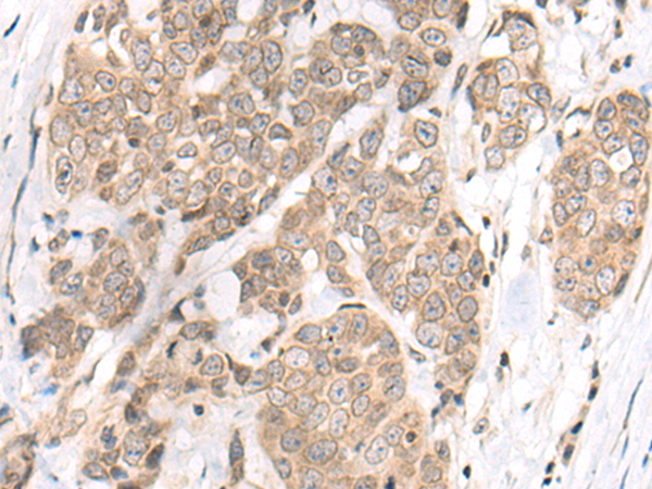 Rabbit Polyclonal Antibody to M1AP