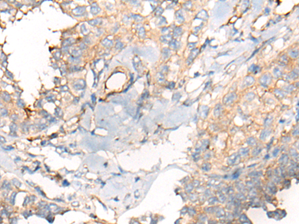 Rabbit Polyclonal Antibody to C4BPA