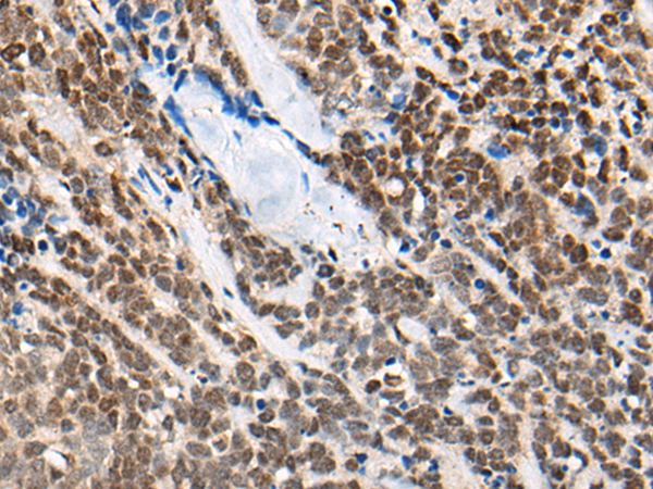 CACNB4