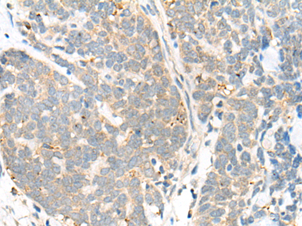 Rabbit Polyclonal Antibody to CALML6