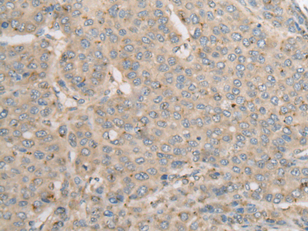 Rabbit Polyclonal Antibody to PRKACA