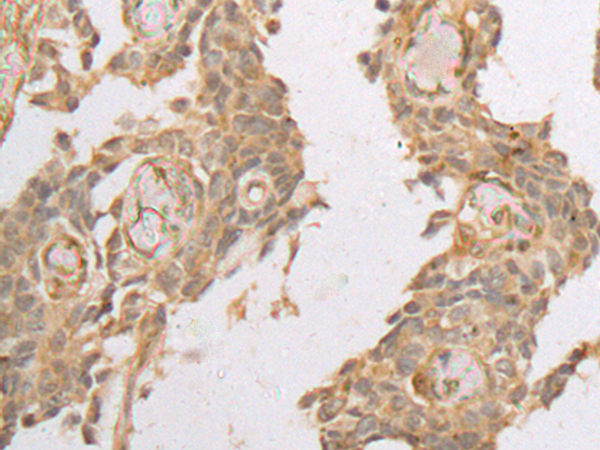 Rabbit Polyclonal Antibody to PRKACA