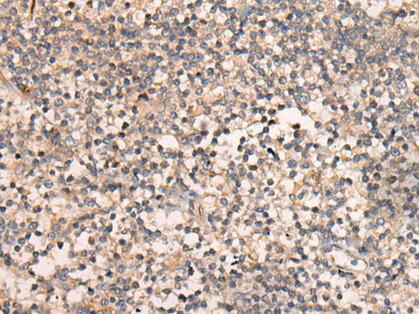 Rabbit Polyclonal Antibody to CARMIL1