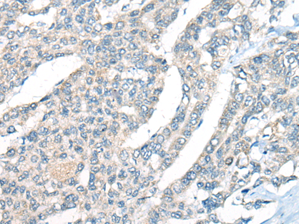 Rabbit Polyclonal Antibody to CTSF