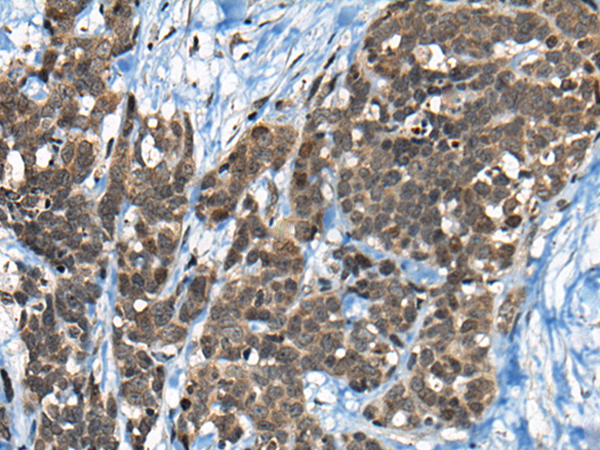 Rabbit Polyclonal Antibody to CEBPZ