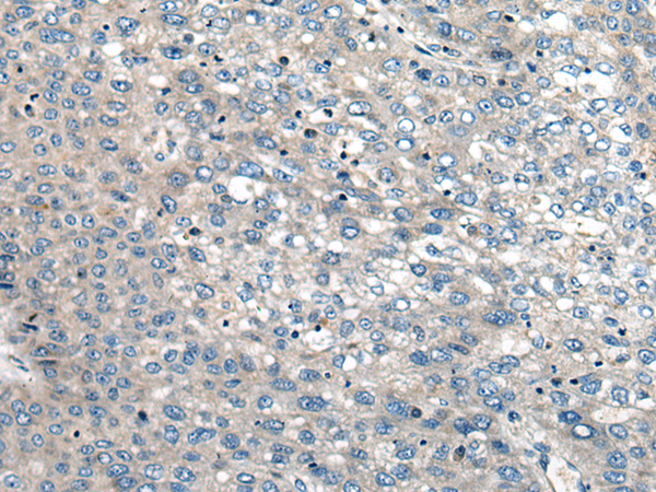 Rabbit Polyclonal Antibody to CEBPZ