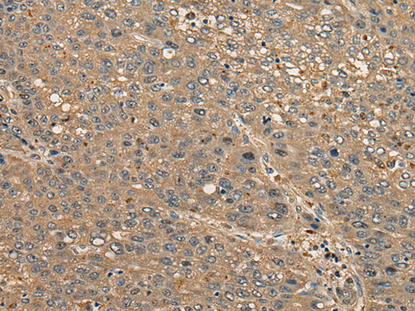Rabbit Polyclonal Antibody to CCDC85C