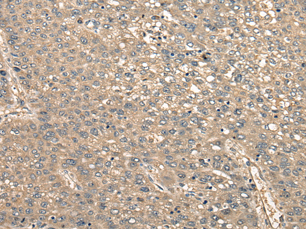 CCDC102A