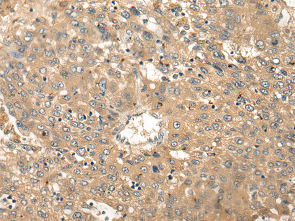 CDK20