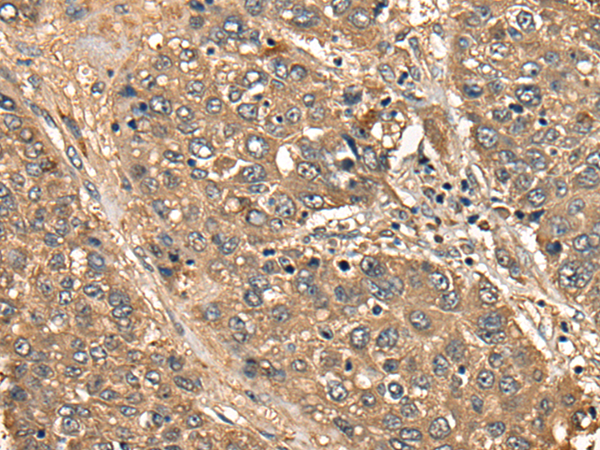 CD1B