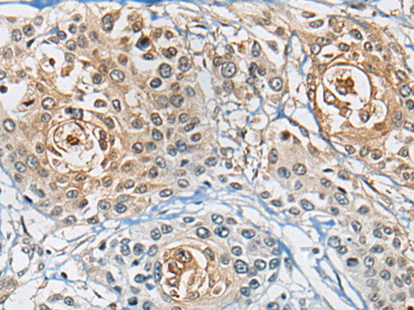 CD8A