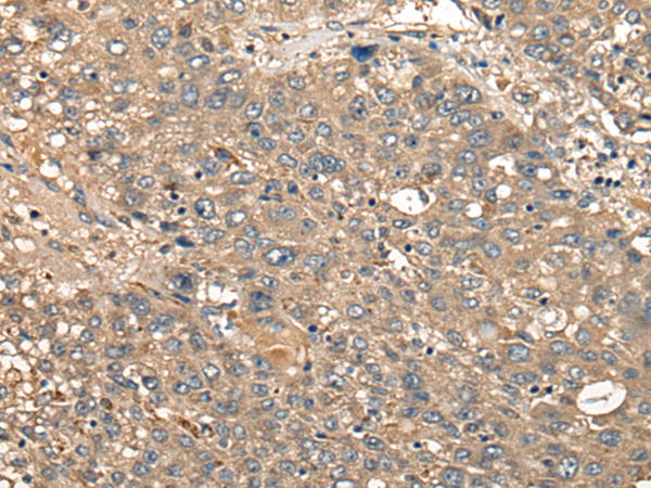 CDC20B