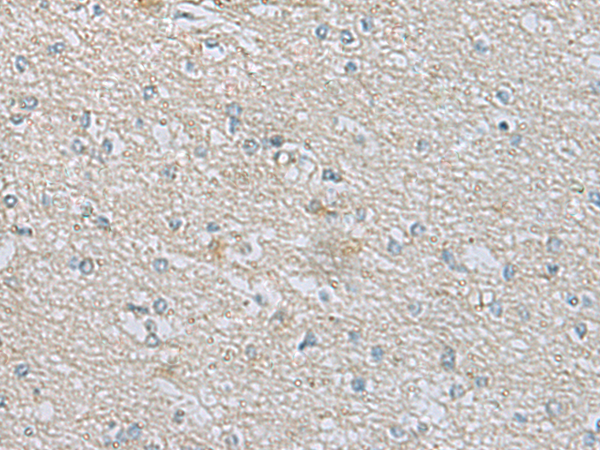 CDH12