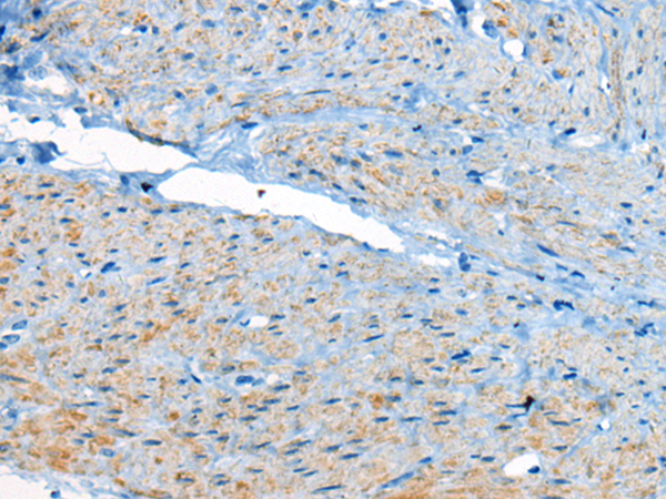 CEP104
