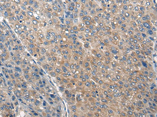 COL25A1