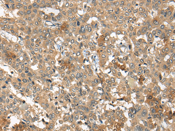 ARCN1