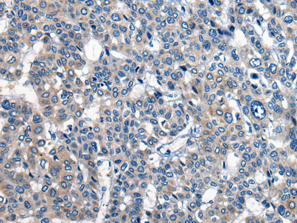 CDH17