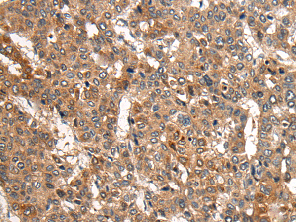 CDH23