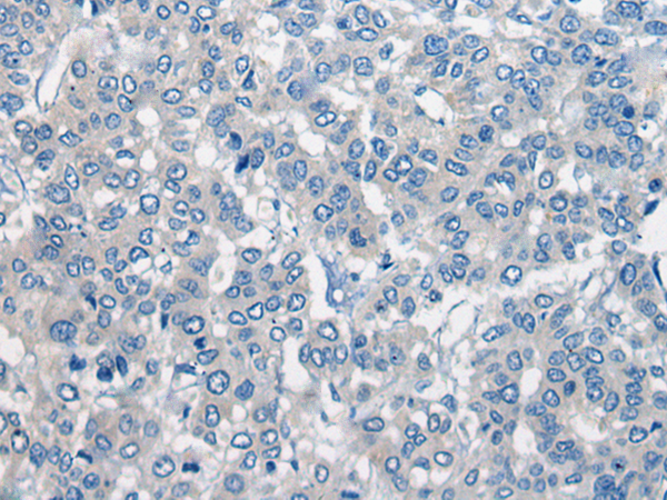 SLC15A1