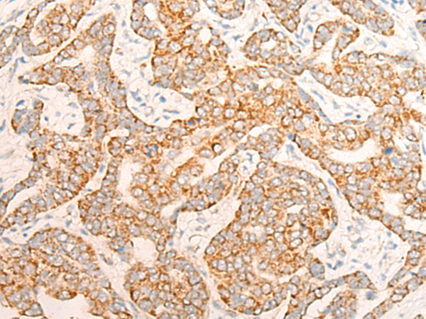 Rabbit Polyclonal Antibody to ALDH7A1