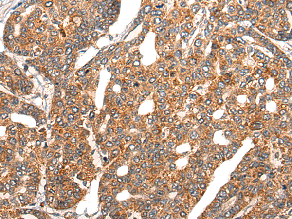 Rabbit Polyclonal Antibody to EPHA6
