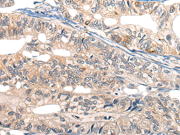 Rabbit Polyclonal Antibody to EPHA6