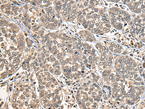 Rabbit Polyclonal Antibody to DGKI