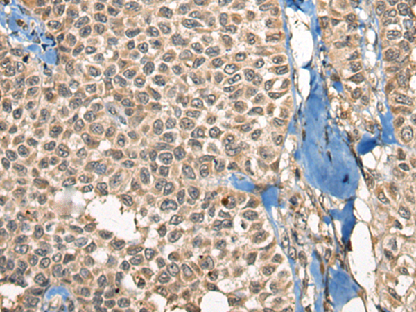 Rabbit Polyclonal Antibody to CHFR