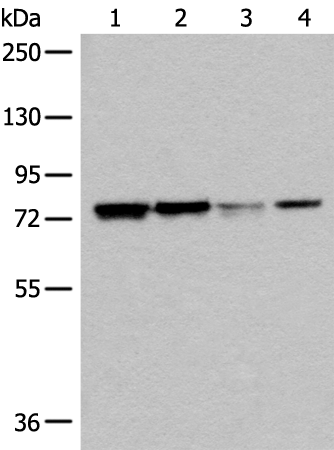 DYRK1A