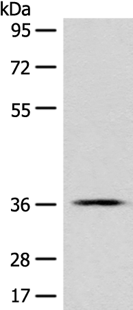 GPR55