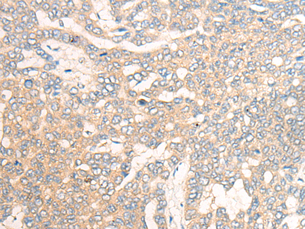 HCRT(Orexin-B)