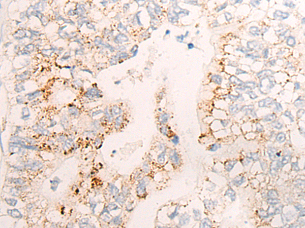 CYP26C1