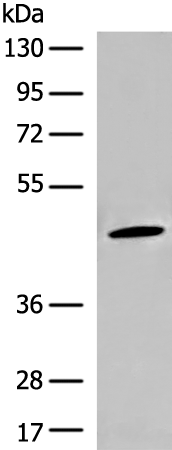 SLC37A4