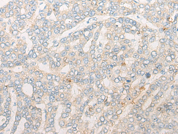 Rabbit Polyclonal Antibody to SLC37A4