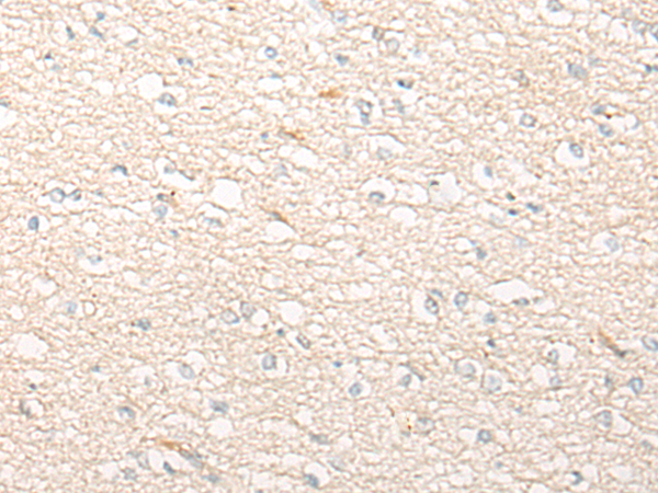 Rabbit Polyclonal Antibody to SLC39A4