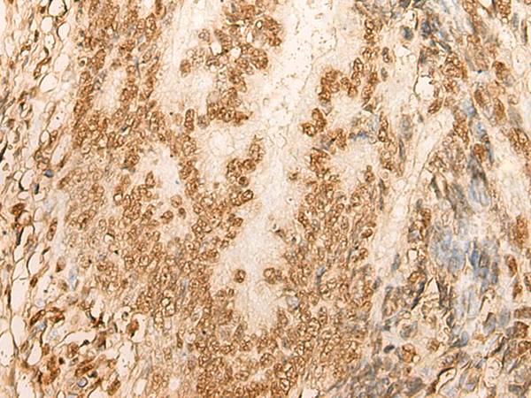Rabbit Polyclonal Antibody to H2BC1