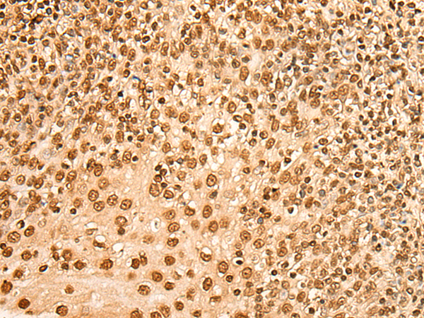Rabbit Polyclonal Antibody to H2BC1