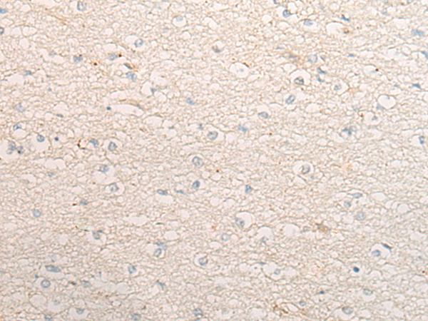 Rabbit Polyclonal Antibody to IL20RB