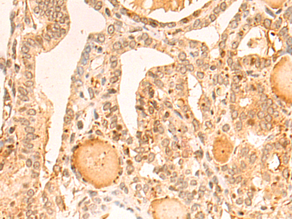 Rabbit Polyclonal Antibody to SGCG