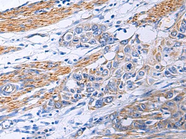 Rabbit Polyclonal Antibody to POLQ