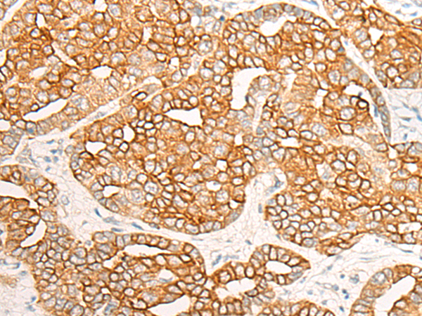RNF19A